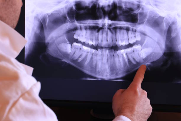 Best Pediatric Emergency Dentist in Grand Point, LA