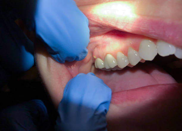 Best Emergency Treatment for Toothache in Grand Point, LA